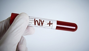 1 Aralık Dünya AIDS günü