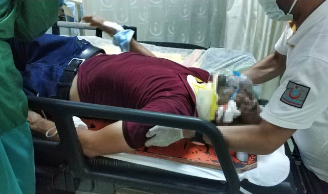 Samsun'da trafik kazası: 1 yaralı