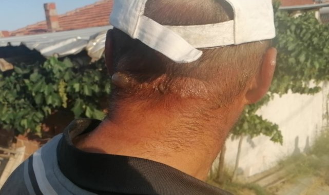 Borcunu yeni bitirdiği traktörünü alevlerin arasında bırakıp canını zor kurtardı