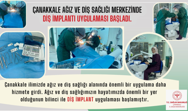 İmplant uygulaması başladı